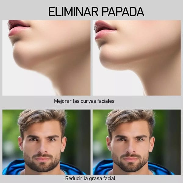 Pack Ejercitador De Mandibula Masticador Facial Mentón X 2 - Imagen 3