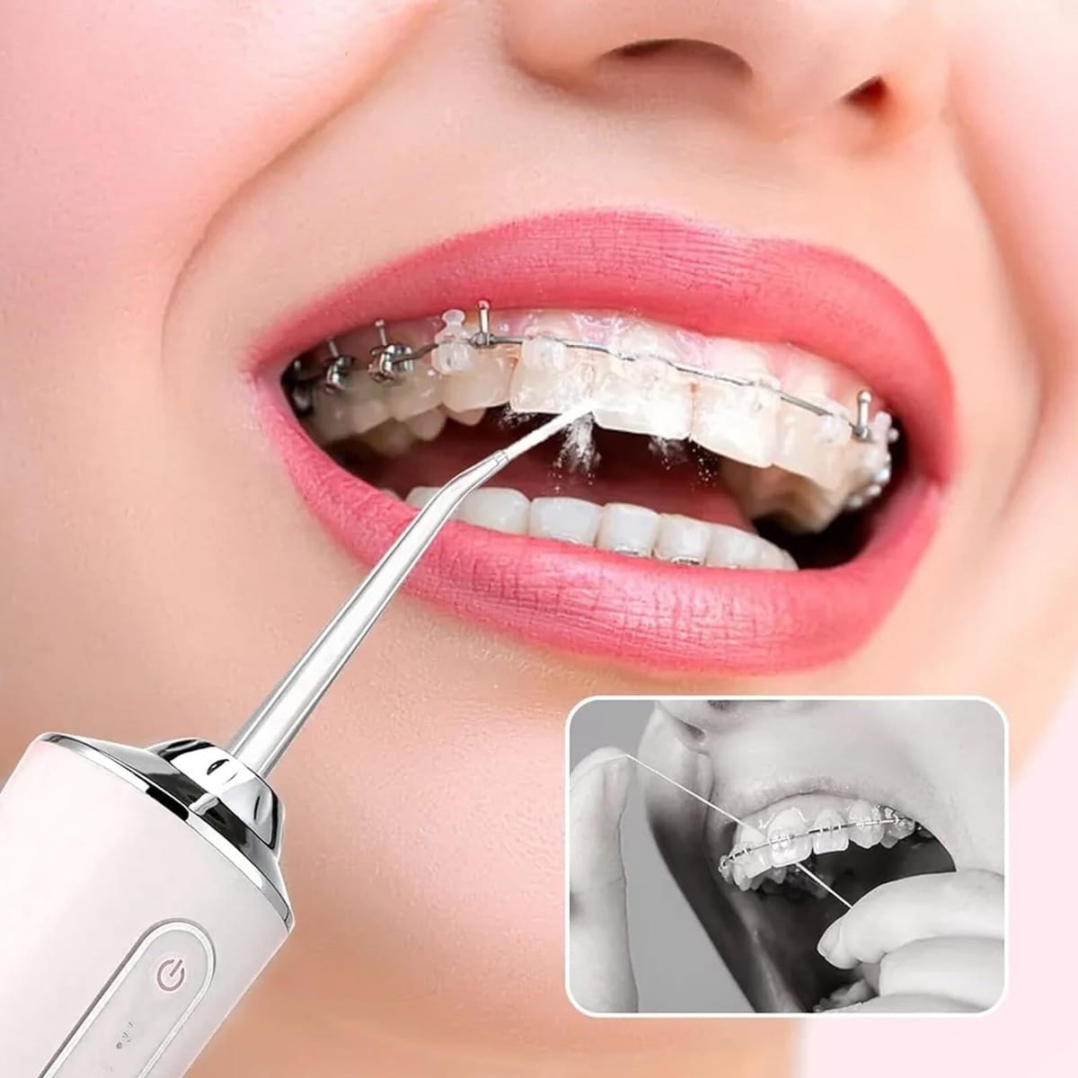Irrigador Bucal Inalámbrico Limpiador Oral Dental Brackets - Imagen 2