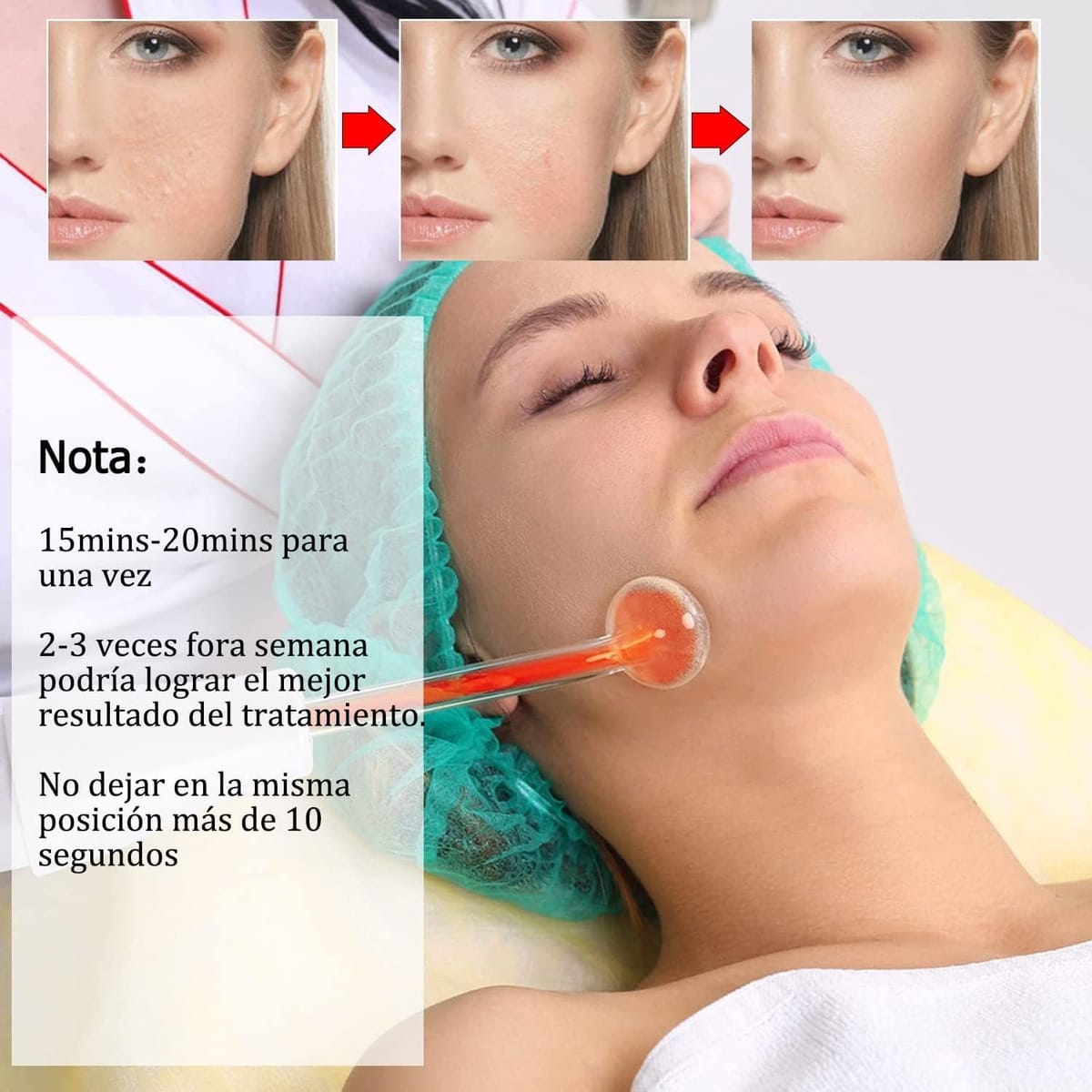 Máquina Facial Alta Frecuencia Equipo Para La Piel Portatil - Imagen 5