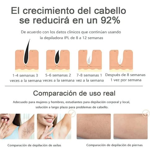 Depiladora De Luz Pulsada Laser Permanente Sin Dolor Ipl - Imagen 7